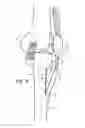 Fig. 09 - ORTHOPEDIC IMPLANTS