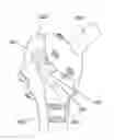 Fig. 01 - ARTIFICIAL HIP JOINT REPLACEMENT SYSTEM