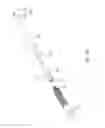 Fig. 04 - ARTIFICIAL HIP JOINT REPLACEMENT SYSTEM