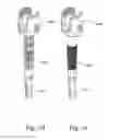 Fig. 06 - ARTIFICIAL HIP JOINT REPLACEMENT SYSTEM