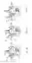 Fig. 15 - ARTIFICIAL HIP JOINT REPLACEMENT SYSTEM