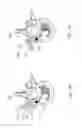 Fig. 19 - ARTIFICIAL HIP JOINT REPLACEMENT SYSTEM