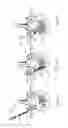 Fig. 20 - ARTIFICIAL HIP JOINT REPLACEMENT SYSTEM