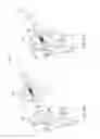 Fig. 22 - ARTIFICIAL HIP JOINT REPLACEMENT SYSTEM