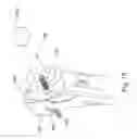 Fig. 24 - ARTIFICIAL HIP JOINT REPLACEMENT SYSTEM