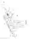 Fig. 26 - ARTIFICIAL HIP JOINT REPLACEMENT SYSTEM