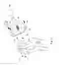 Fig. 27 - ARTIFICIAL HIP JOINT REPLACEMENT SYSTEM