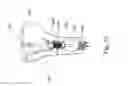 Fig. 31 - ARTIFICIAL HIP JOINT REPLACEMENT SYSTEM