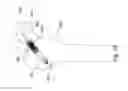 Fig. 34 - ARTIFICIAL HIP JOINT REPLACEMENT SYSTEM