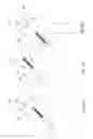 Fig. 35 - ARTIFICIAL HIP JOINT REPLACEMENT SYSTEM