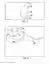 Fig. 03 - Method for Optimization of Joint Arthroplasty Component Design