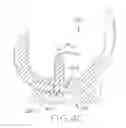 Fig. 13 - Tibial bearing component for a knee prosthesis with improved articular characteristics
