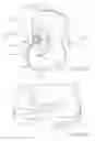 Fig. 16 - Tibial bearing component for a knee prosthesis with improved articular characteristics