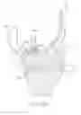 Fig. 18 - Tibial bearing component for a knee prosthesis with improved articular characteristics