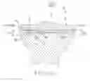 Fig. 25 - Tibial bearing component for a knee prosthesis with improved articular characteristics