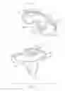 Fig. 27 - Tibial bearing component for a knee prosthesis with improved articular characteristics