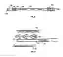 Fig. 29 - Expandable fusion device and method of installation thereof