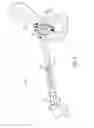 Fig. 07 - Prosthesis alignment system