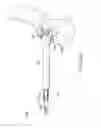Fig. 09 - Prosthesis alignment system