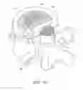 Fig. 83 - Impaction systems