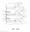 Fig. 87 - Impaction systems