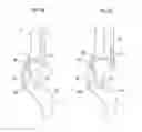 Fig. 13 - Joint mechanism control device