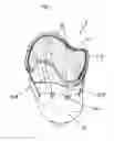 Fig. 02 - Prosthesis socket with insertion aid