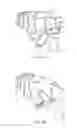 Fig. 05 - Trigger wire arrangements for endografts