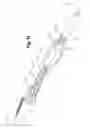 Fig. 27 - Deployment handle for delivery device with mechanism for quick release of a prosthesis and re-sheathing of device tip