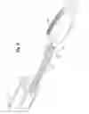 Fig. 30 - Deployment handle for delivery device with mechanism for quick release of a prosthesis and re-sheathing of device tip