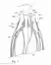 Fig. 07 - Circumferential trigger wire for deploying an endoluminal prosthesis