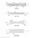 Fig. 05 - Segmented scaffolds and delivery thereof for peripheral applications
