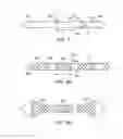 Fig. 06 - Segmented scaffolds and delivery thereof for peripheral applications
