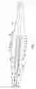 Fig. 02 - Prosthesis delivery systems having an atraumatic tip for use with trigger wires