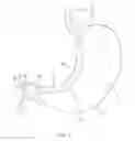 Fig. 04 - Method for performing a gastrectomy