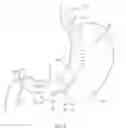 Fig. 06 - Method for performing a gastrectomy