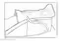 Fig. 01 - Immobilization device utilizing a splint and pillow combination