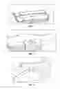 Fig. 03 - Immobilization device utilizing a splint and pillow combination