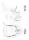 Fig. 03 - External Mandibular Advancement Splint