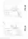 Fig. 05 - External Mandibular Advancement Splint
