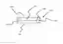 Fig. 01 - Mandibular advancement device