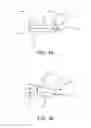Fig. 02 - Mandibular advancement device