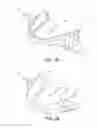 Fig. 03 - Mandibular advancement device
