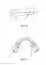 Fig. 06 - Mandibular advancement device