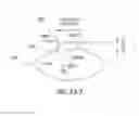 Fig. 05 - Capsular membrane treatments to increase accommodative amplitude