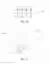 Fig. 12 - Method for Wound Infection Prevention