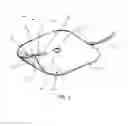 Fig. 02 - Reduced pressure therapy of the sacral region