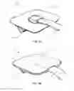 Fig. 13 - Reduced pressure therapy of the sacral region