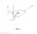 Fig. 18 - Reduced pressure therapy of the sacral region