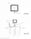 Fig. 25 - Reduced pressure therapy of the sacral region